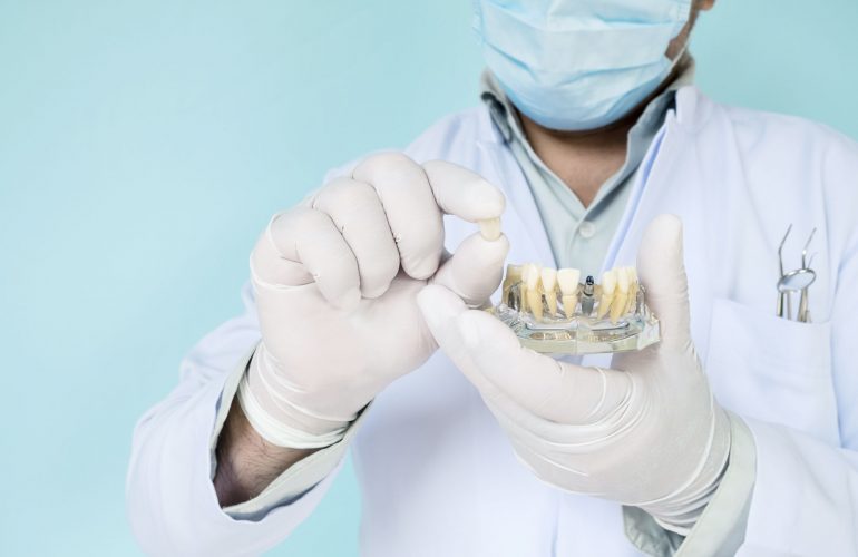 Implantologia dentale a carico immediato