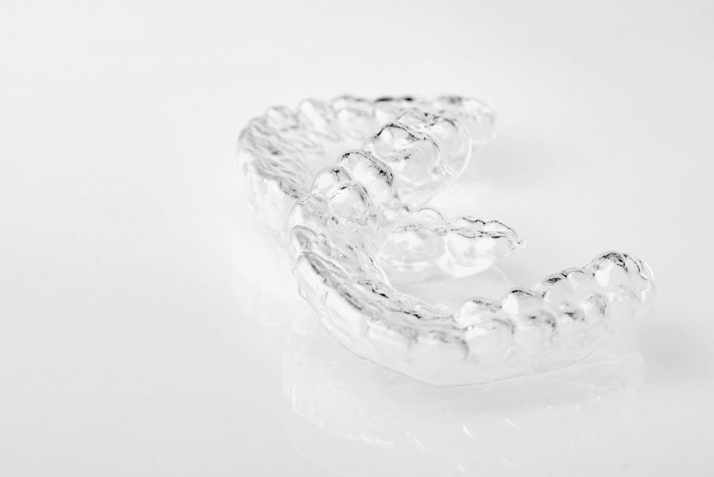 apparecchio invisalign